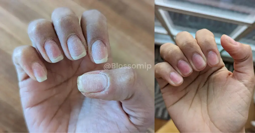 How to Remove Gel Nail Polish at Home?