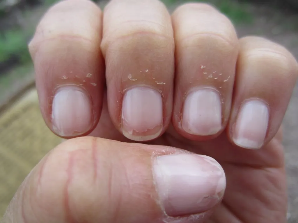 Dry Cracked Cuticles